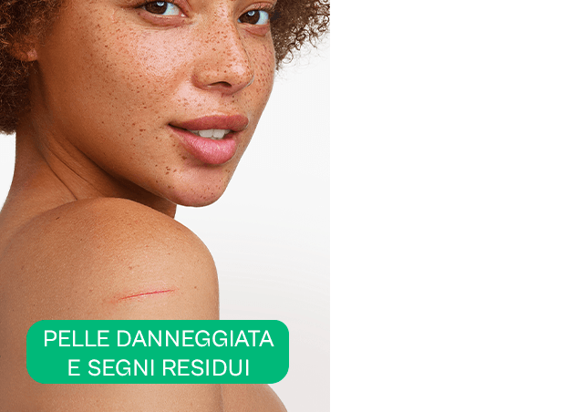 2 3 card a derma