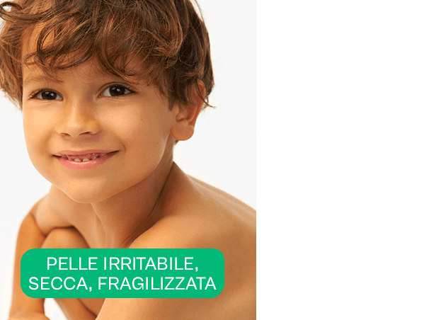 3 3 card a derma