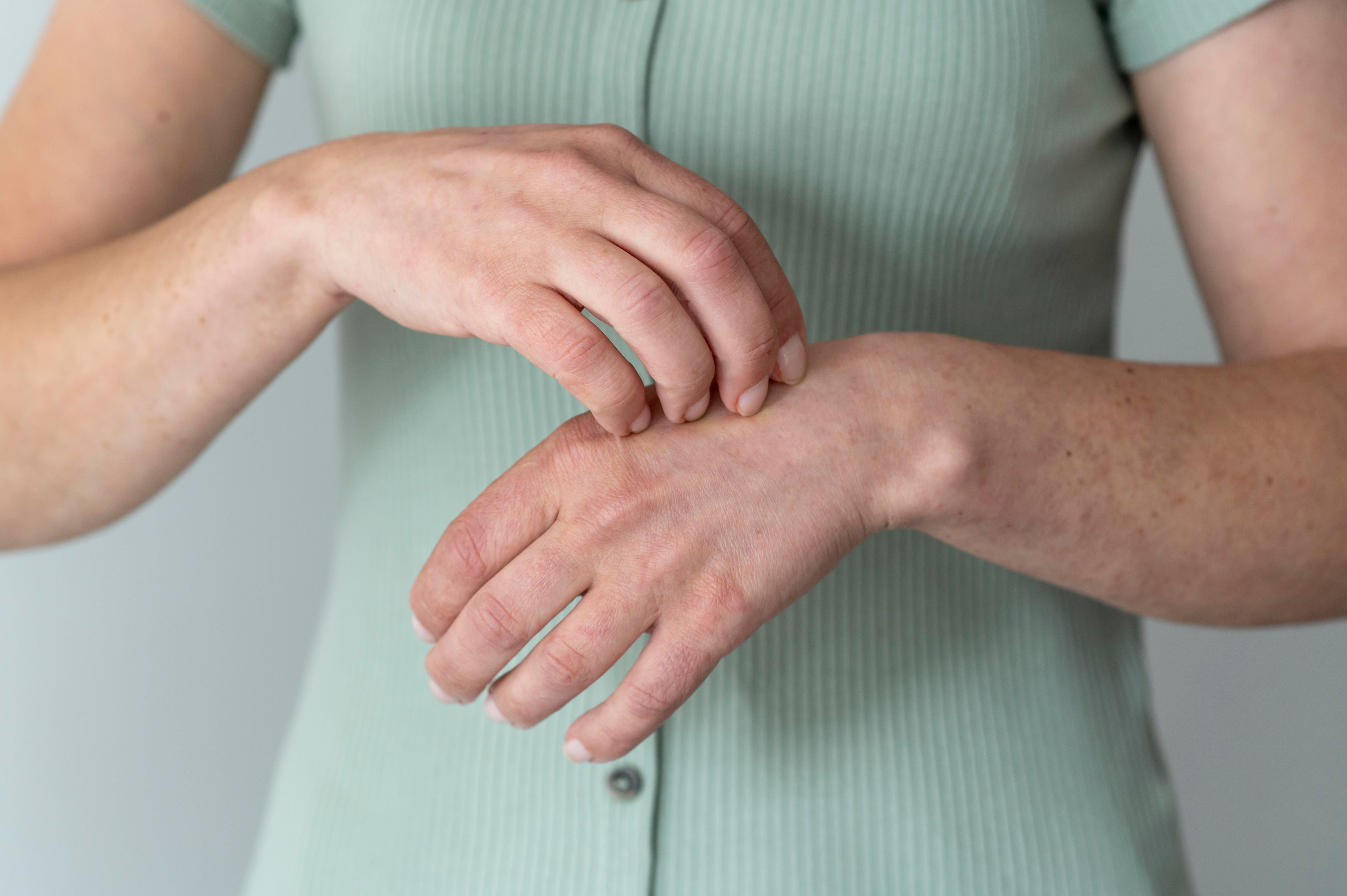 Prurito e diabete: cause, sintomi e rimedi per la pelle secca